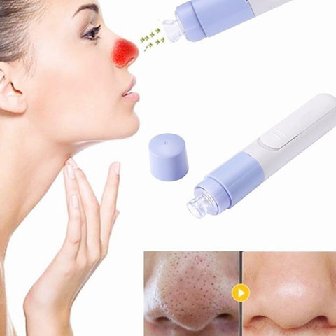 Handheld Blackhead Remover